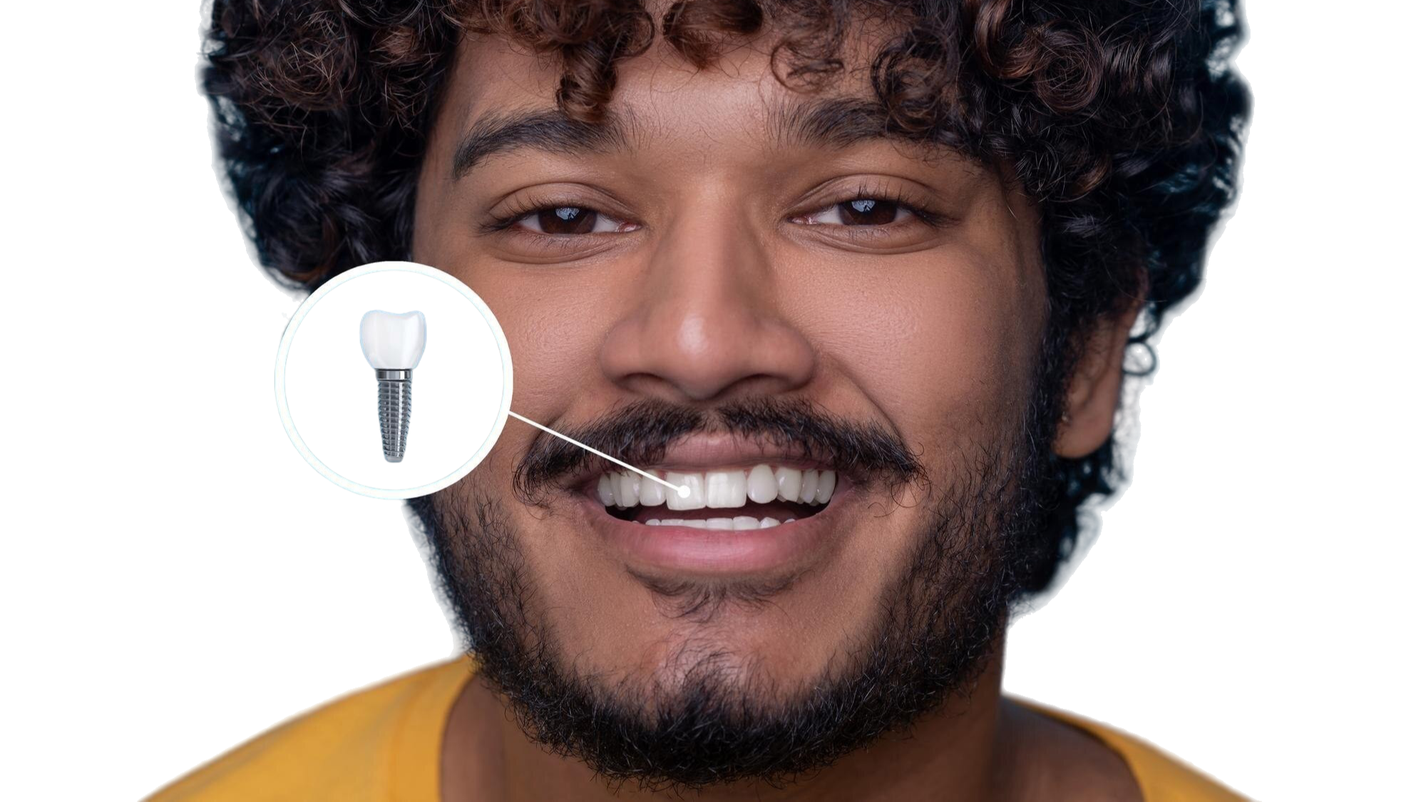 Dental Implant