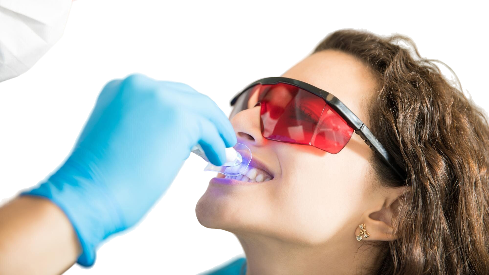Teeth Whitening