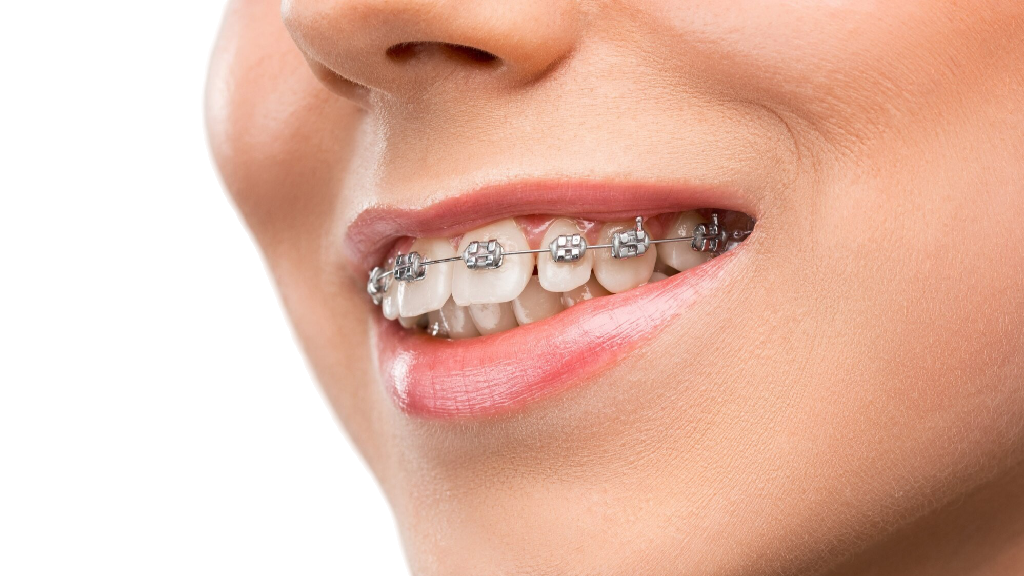Orthodontics